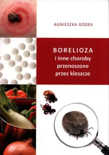 Borelioza i inne choroby przenoszone przez kleszcze 